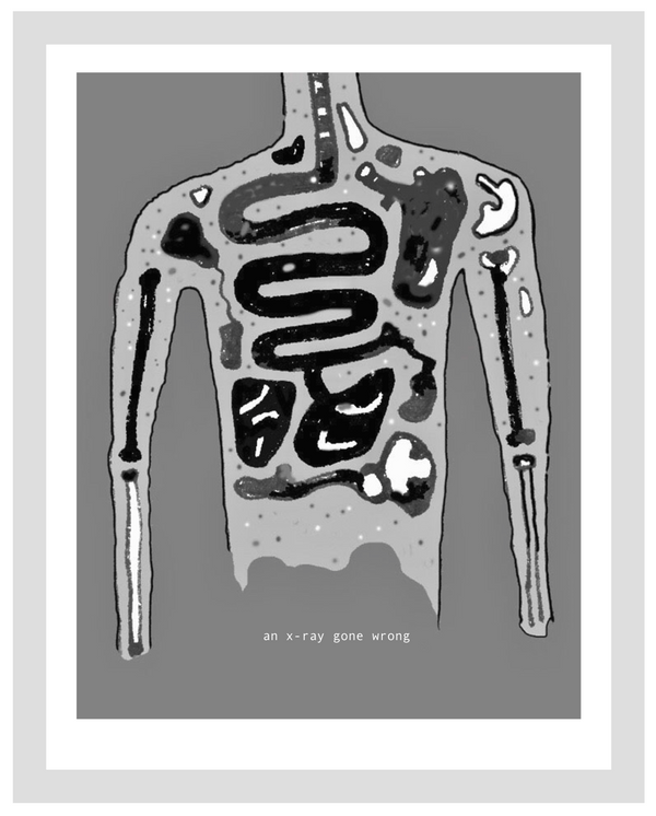 John Waid, An x-ray gone wrong