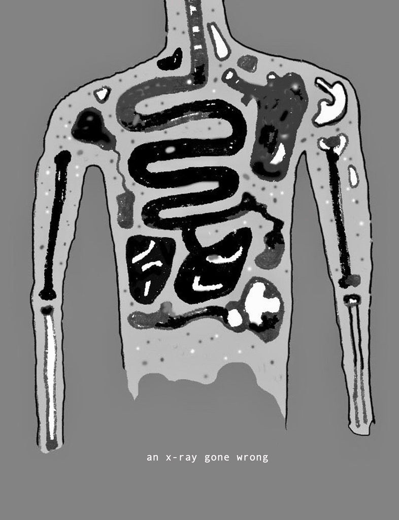 John Waid, An x-ray gone wrong