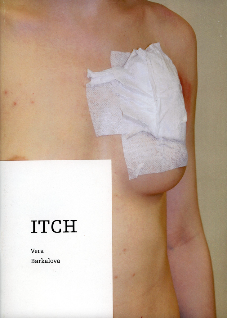 Itch, Vera Barkalova